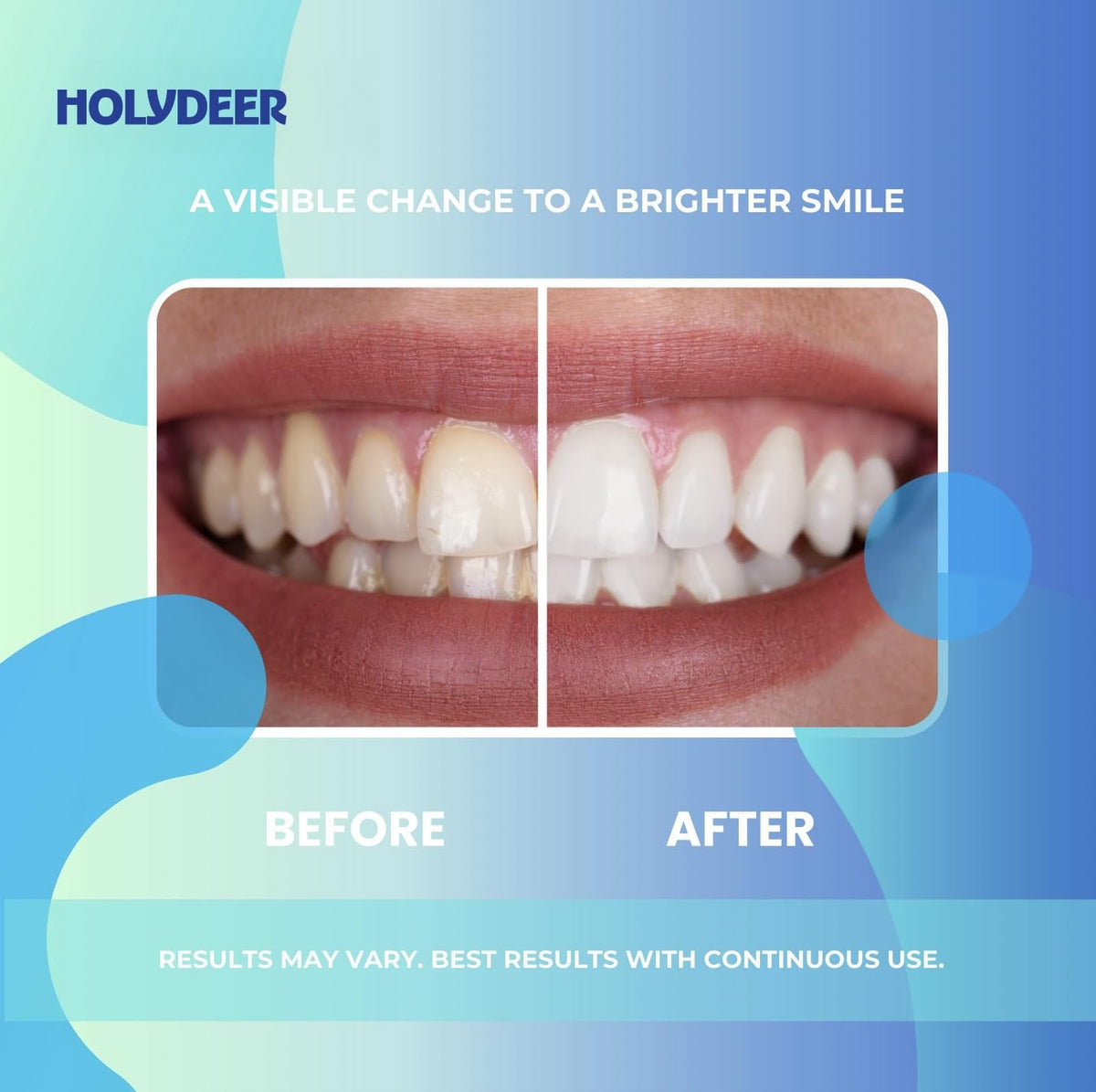 Nano-Hydroxyapatite Toothpaste Mint Fluoride-Free Sensitive Whitening Enamel Care 4.23 oz 3 Pack