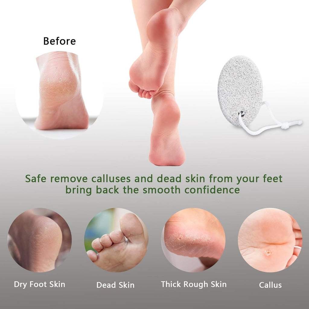 Natural Pumice Stone Foot Scrubber for Callus Removal - 1 or 2-Pack