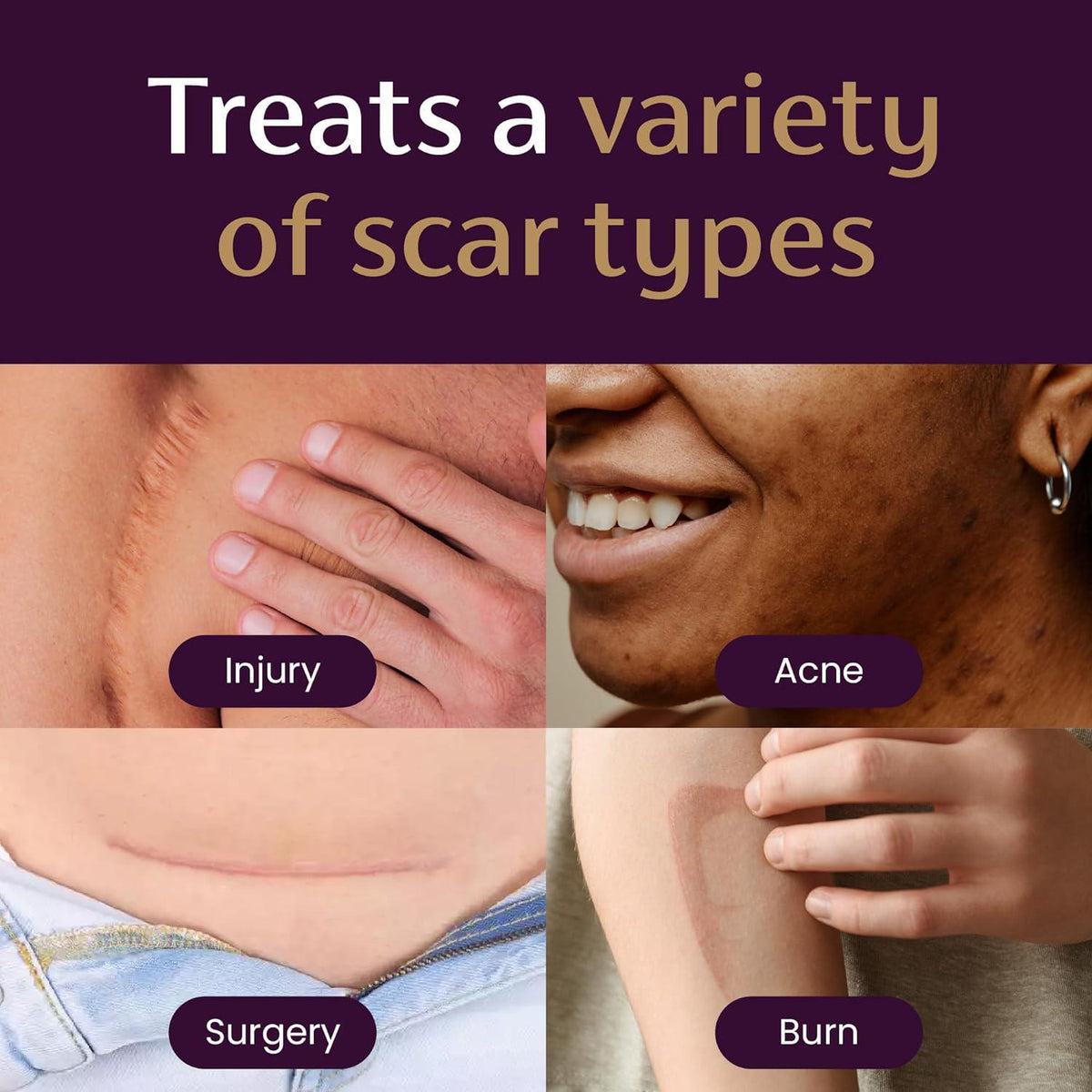 Overnight Scar Cream - Reduce Visible Scars While You Sleep