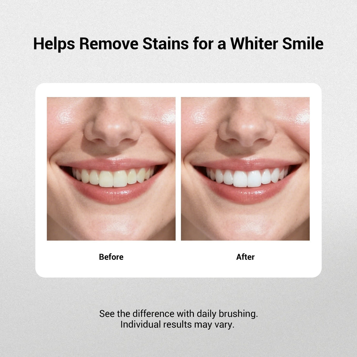 Whitening Toothpaste with Probiotics - Brighten Smile, Fresh Breath, 4.23 oz
