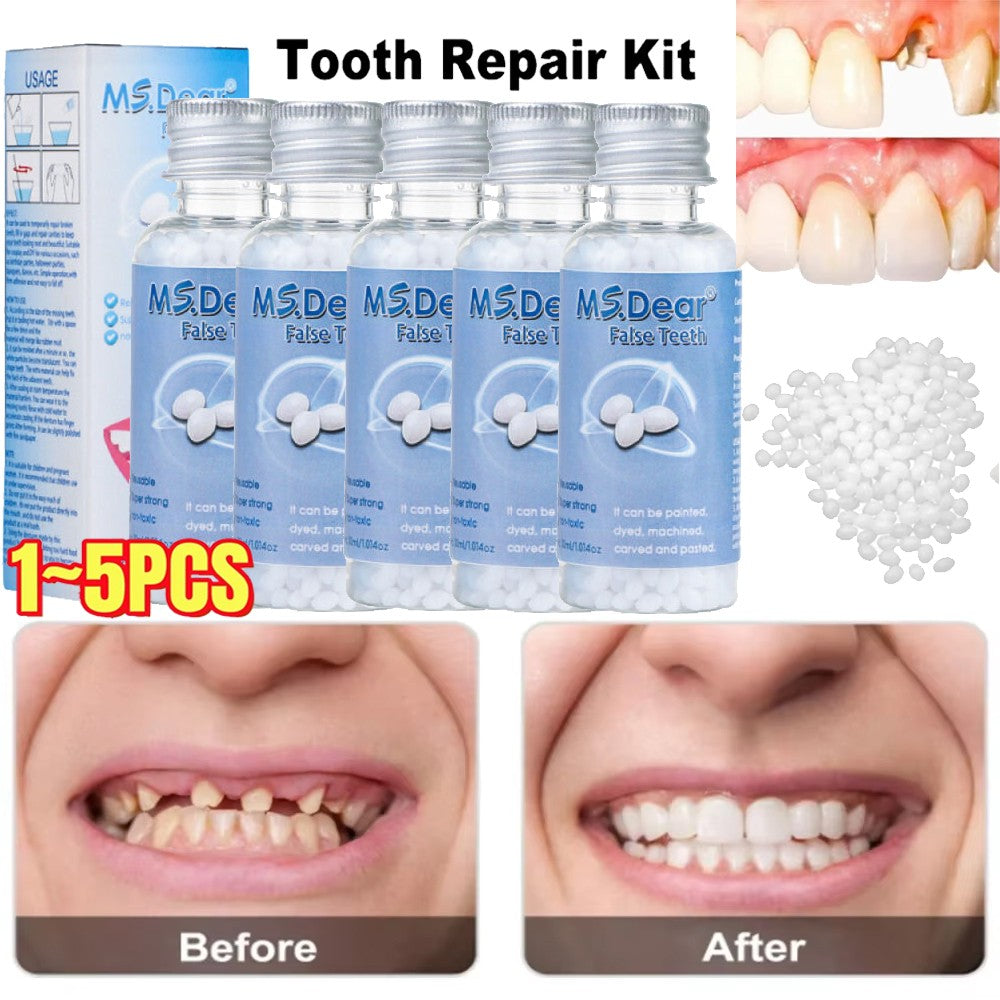 Teeth Repair Kit - Temporary Missing & Broken Tooth Replacement Set - Multiple Quantities