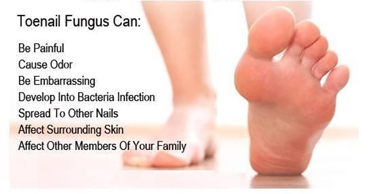 Natural Nail Fungus Treatment for Toe & Finger Nails - Heal & Restore
