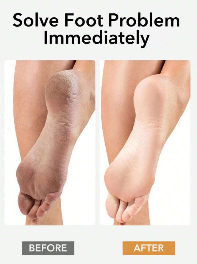 Professional Beech Wood Foot File for Callus & Dead Skin Removal