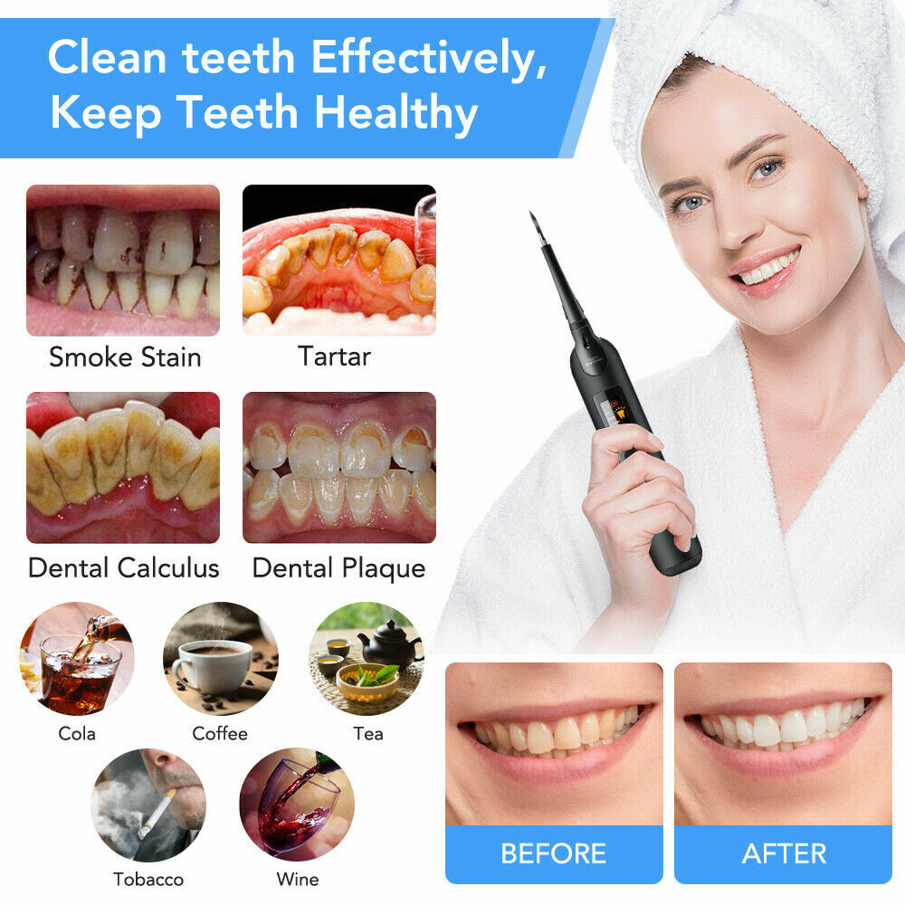 Electric Ultrasonic Tooth Cleaner Dental Tartar Stain Remover Kit