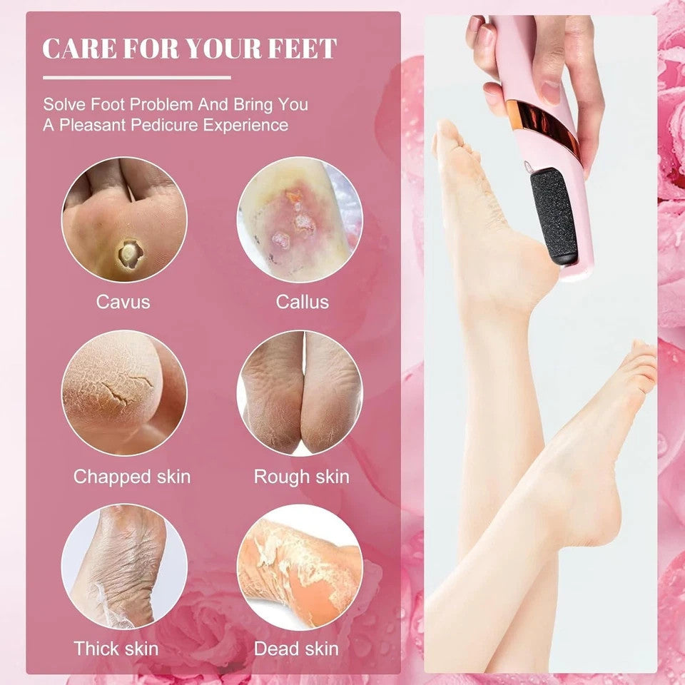 Rechargeable Electric Foot Callus Remover with 2 Sanding Heads for Pedicure & Exfoliation