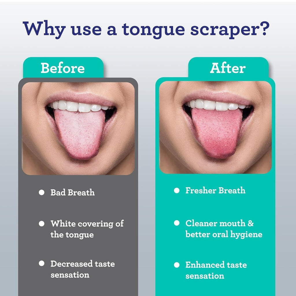 Stainless Steel Tongue Scraper 2 Pack with Travel Case - Oral Hygiene Tool
