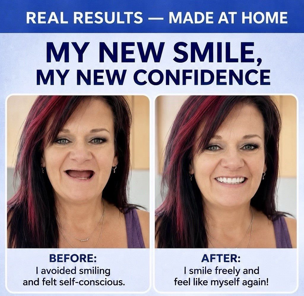 Partial Denture Kit - Make Custom Temporary Teeth A2, Reusable & Easy
