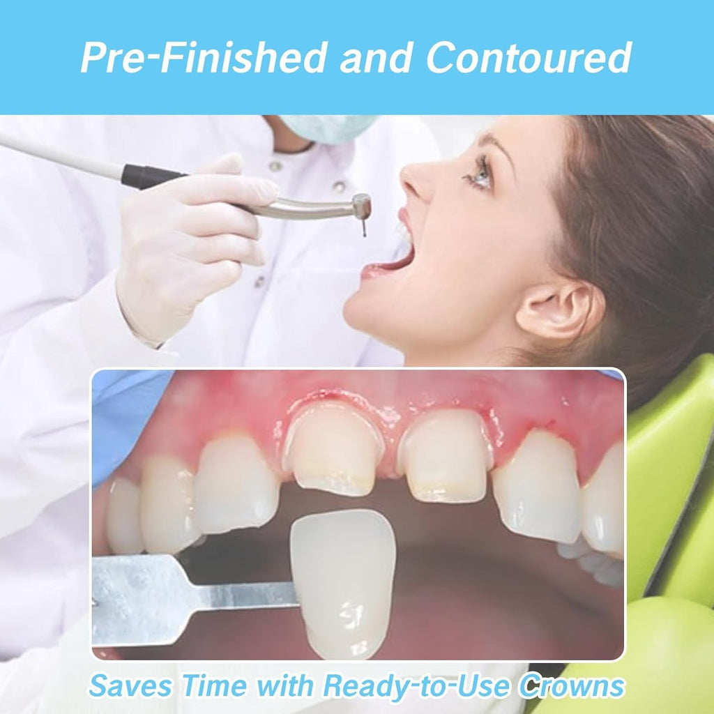 Dental Temporary Crown Kit - Mixed Sizes for Broken Tooth Restoration
