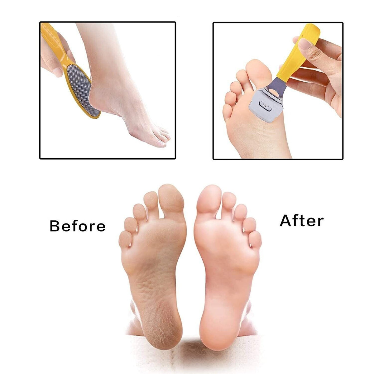 15-in-1 Foot Care Pedicure Kit Stainless Steel Toe Nail Tool Set