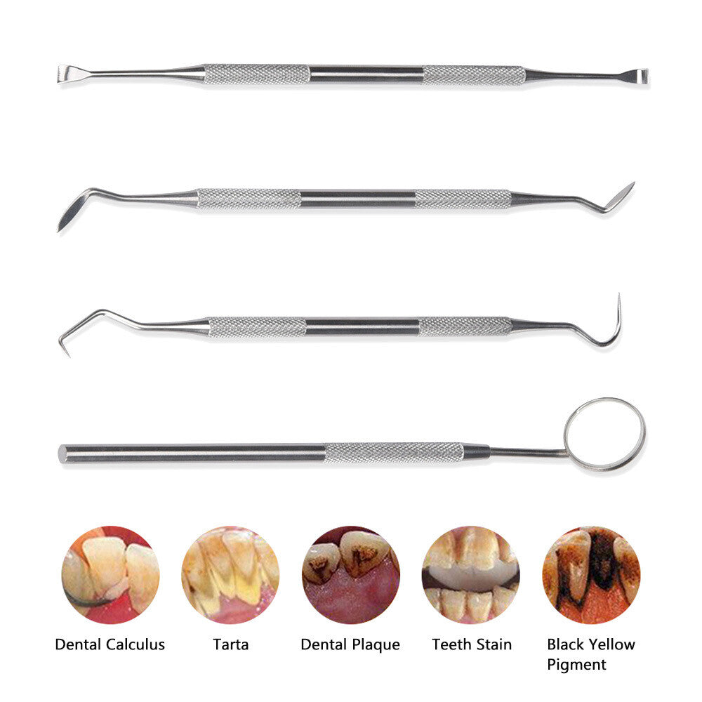 Ultrasonic Electric Tooth Cleaner Tartar & Plaque Remover Dental Tool Kit