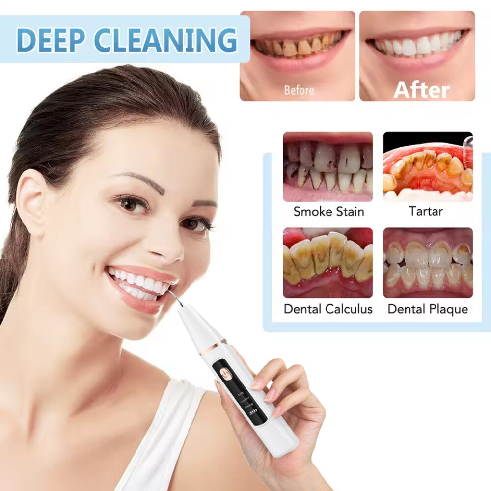 Ultrasonic Tooth Cleaner Tartar Remover with LED Light for Dental Hygiene