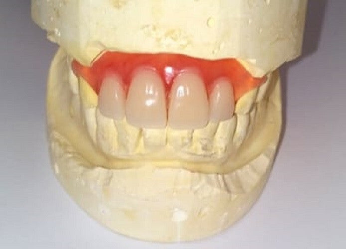 DIY Partial Denture Kit for At-Home Custom Dentures with Shades & Instructions