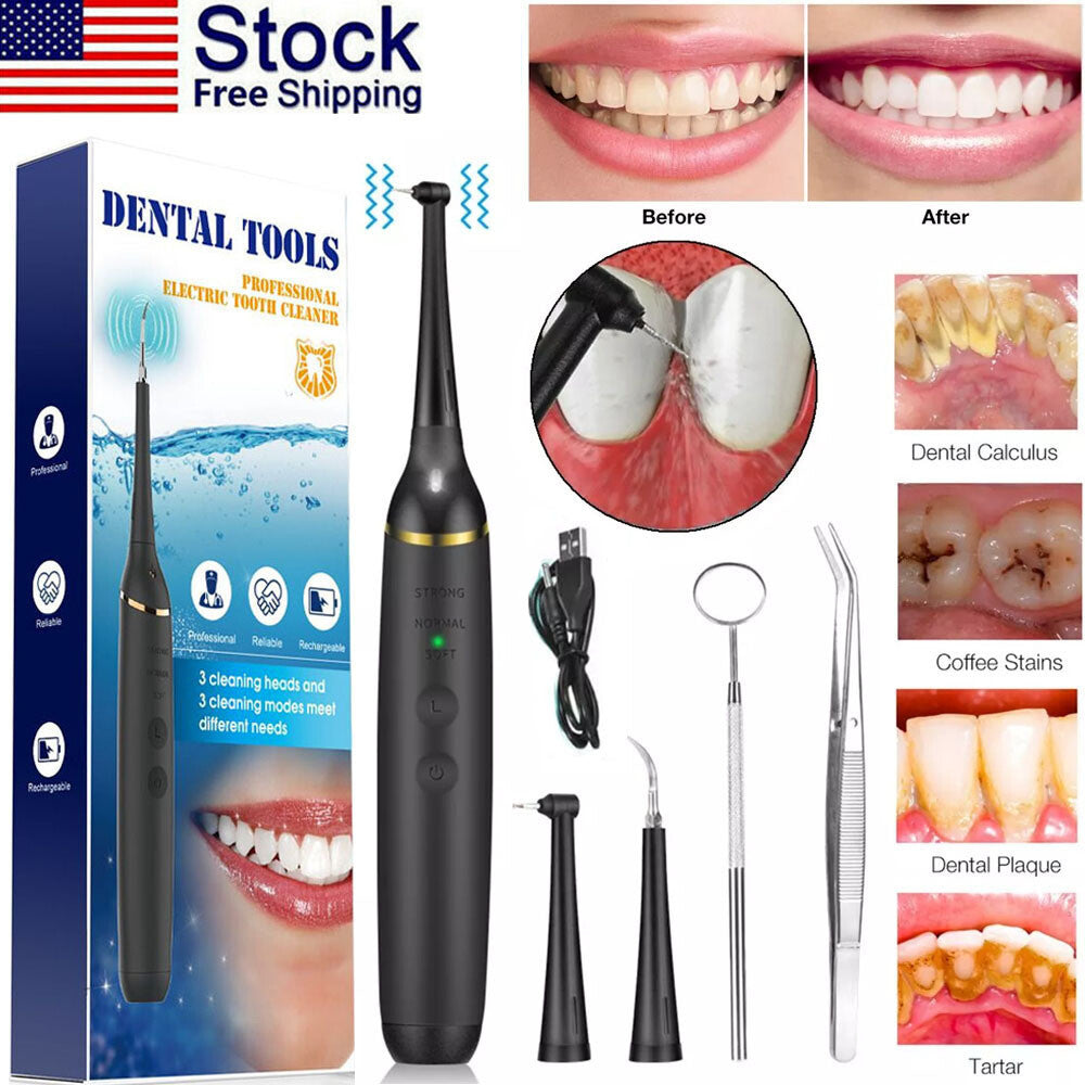 Portable Ultrasonic Tooth Cleaner Plaque & Tartar Remover - Rechargeable Dental Hygiene Device