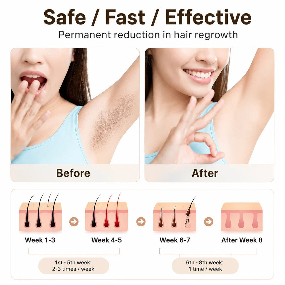 IPL Laser Hair Removal Device with 999,999 Flashes for Safe Permanent Hair Reduction