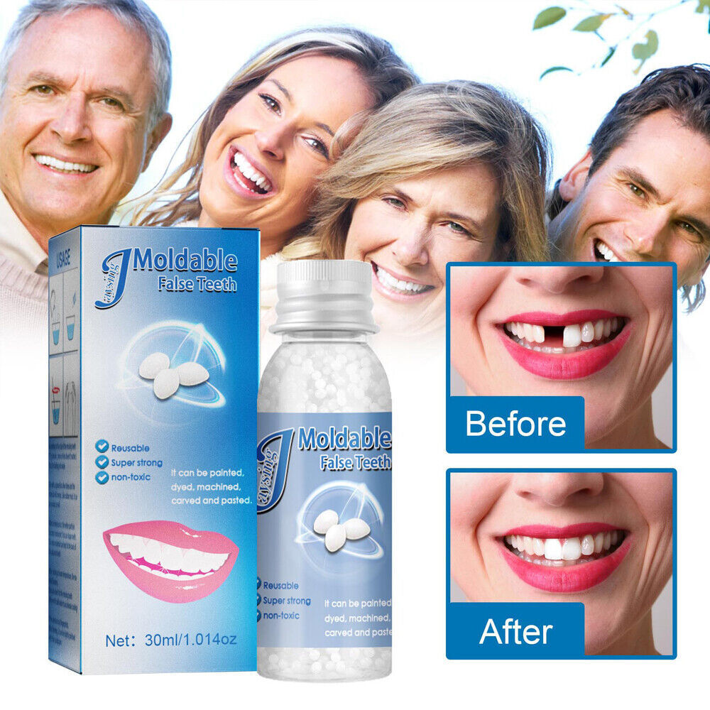 Teeth Repair Beads for Loose Tooth Fixing - Temporary Dental Moldable Resin