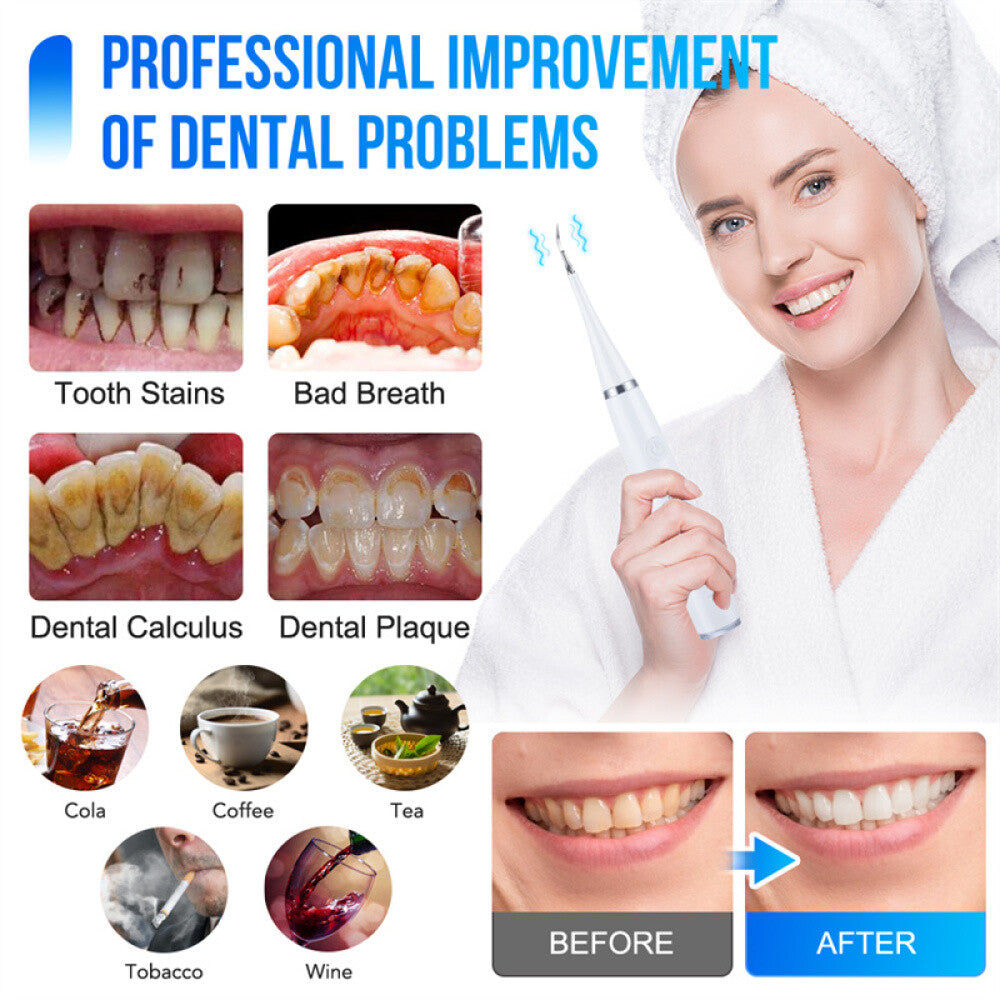 Electric Ultrasonic Tooth Cleaner Dental Scaler Tartar Remover