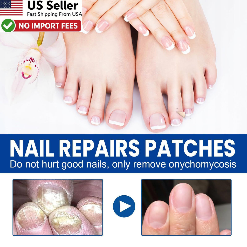 Fungal Nail Treatment Patches 60 Pack - Toenail Repair & Discoloration Relief
