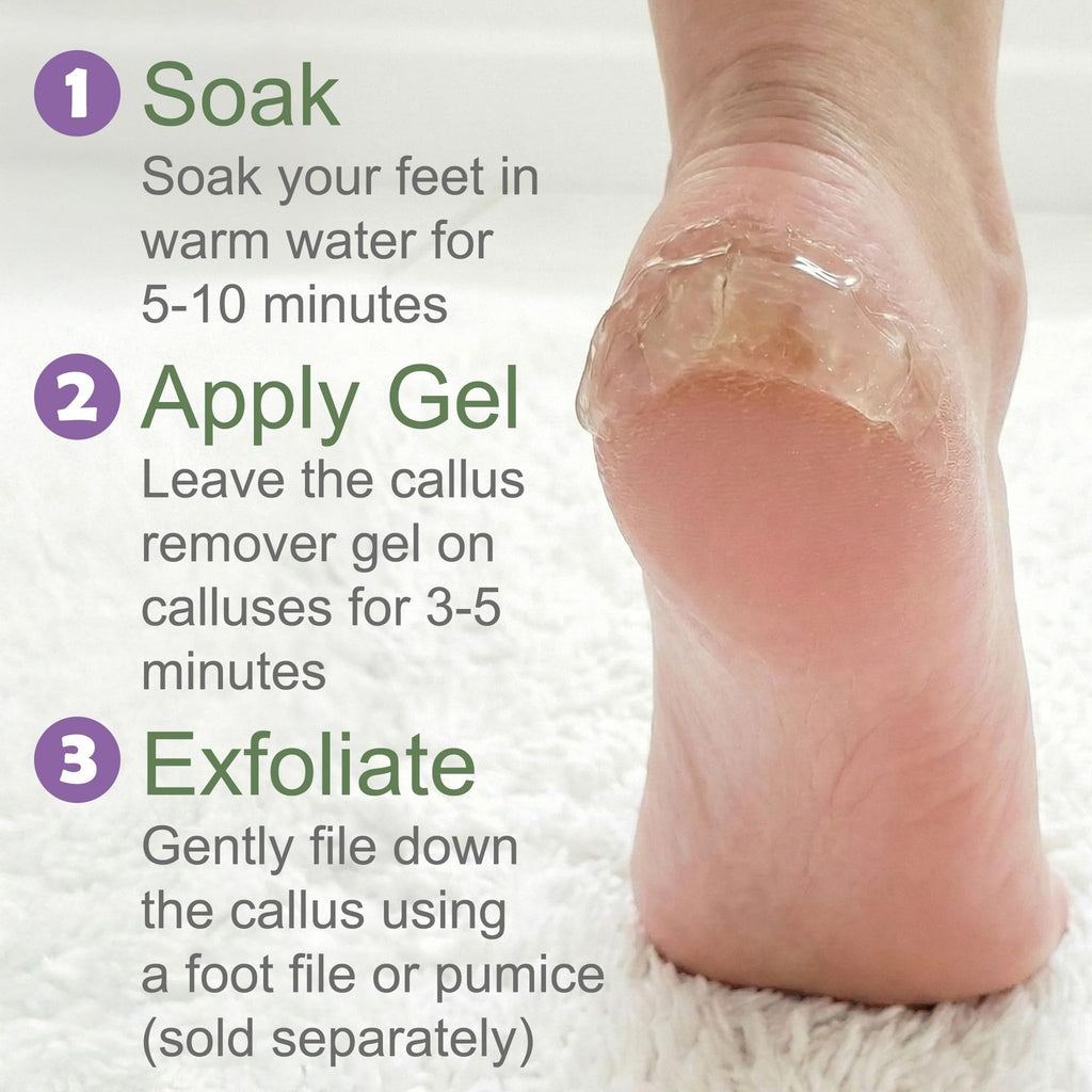 Extra Strength Foot Callus Remover Gel - 16 oz Professional Foot Care Treatment