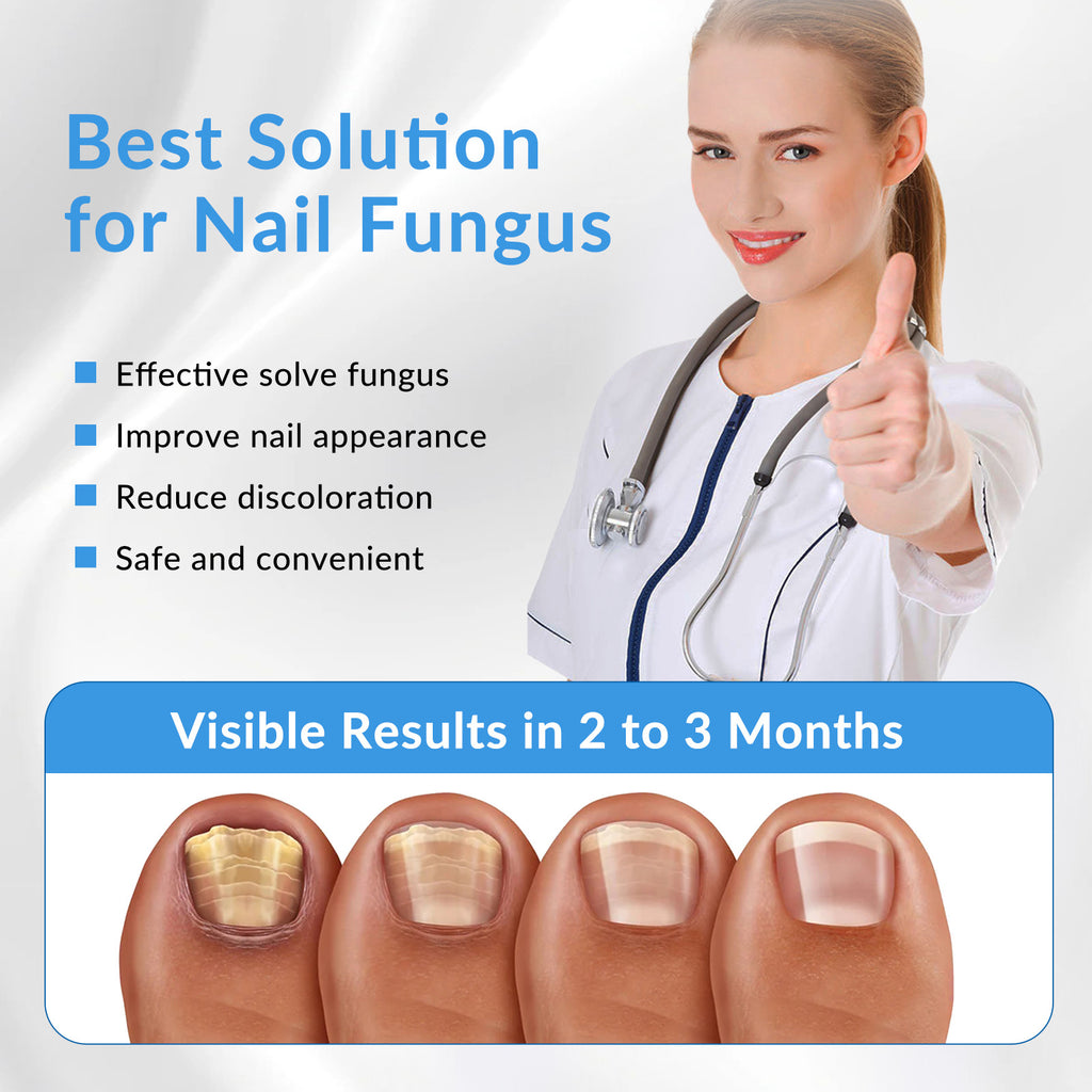Nail Fungus Laser Treatment Device for Toenail & Fingernail Care