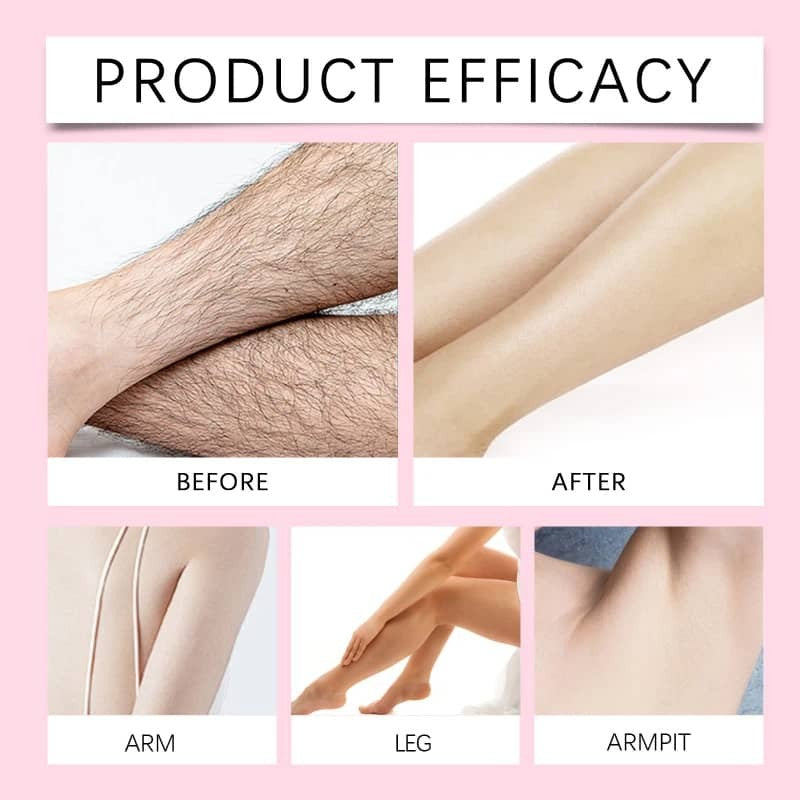 Gentle Intimate Hair Removal Cream for Girls and Women - 120g
